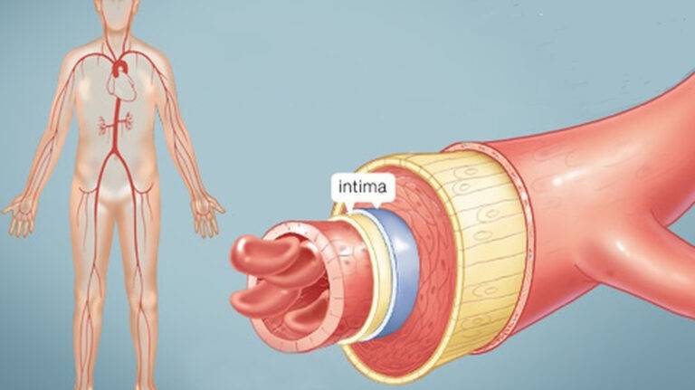 Arteries