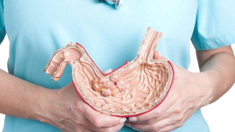 Gastroenterology (Digestive System)